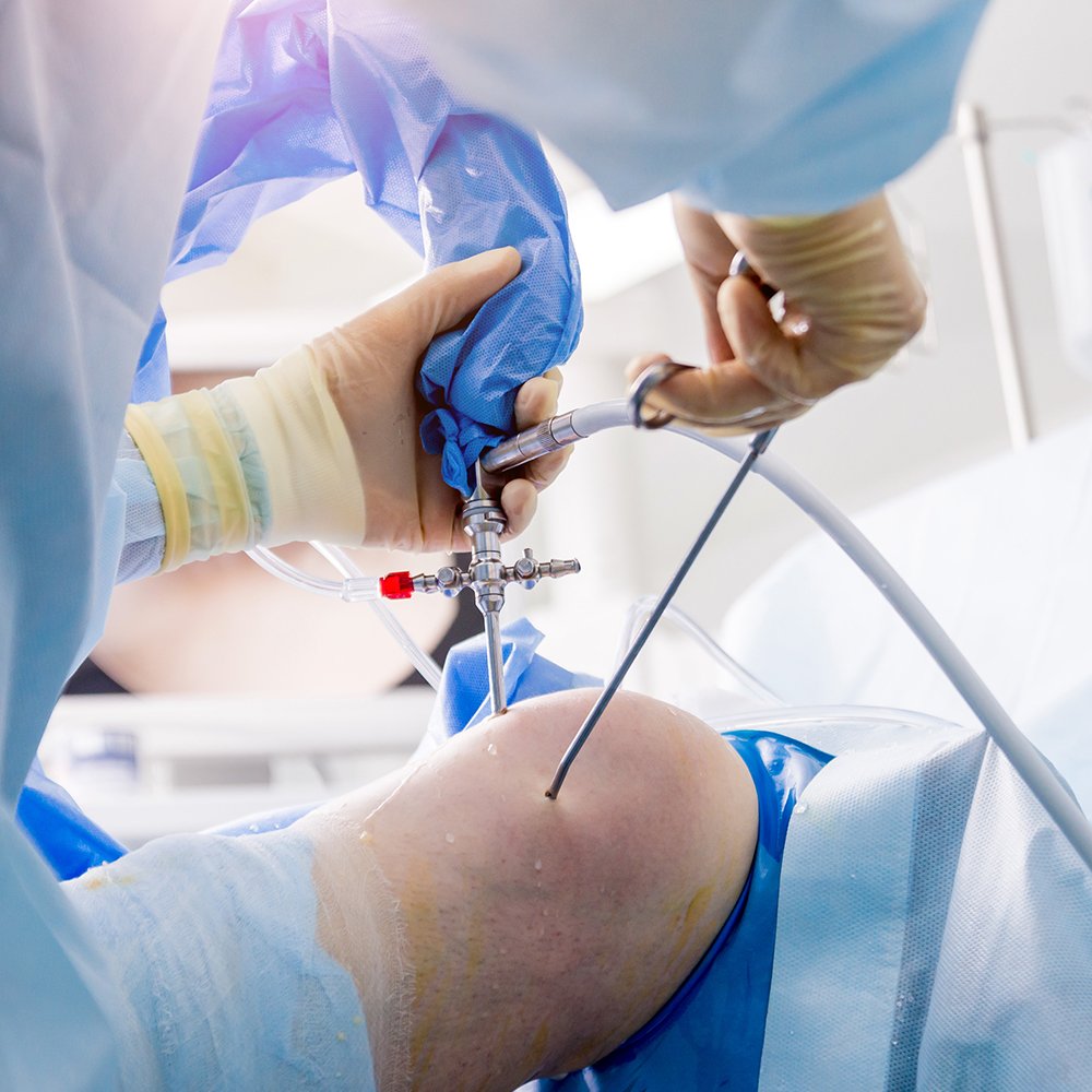  Arthroscopy & Arthroscopic procedures of Knee / Shoulder