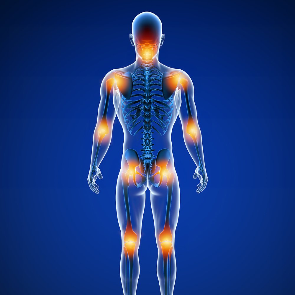 General Bone & Joint disorders